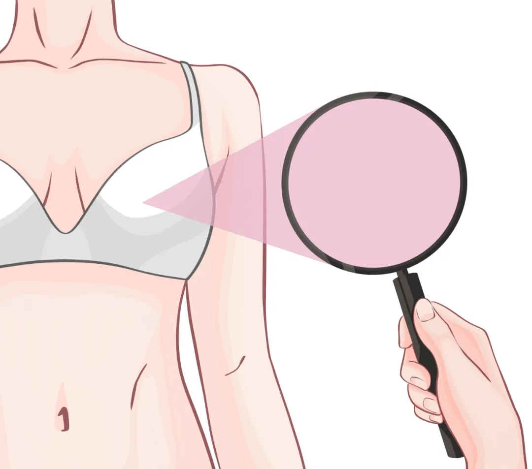 切莫盲目丰胸！一不小心陷误区！