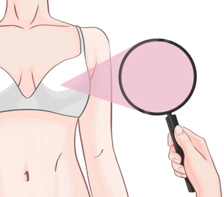 乳腺癌可防可治，建议收藏反复阅读！