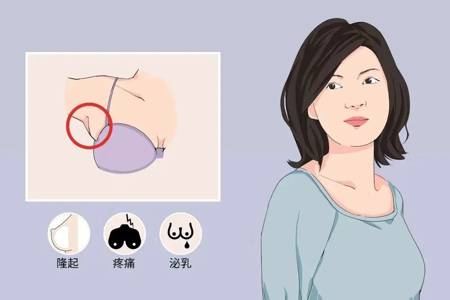 什么是副乳？我该怎么办？