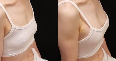 学会这些就能丰胸美乳？你试过吗？