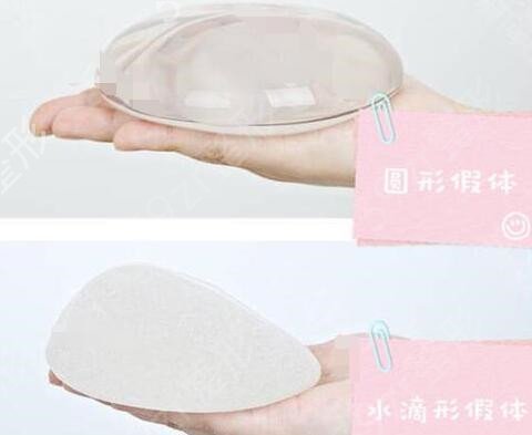 假体隆胸应该怎么?。渴屎夏男┤巳海? title=