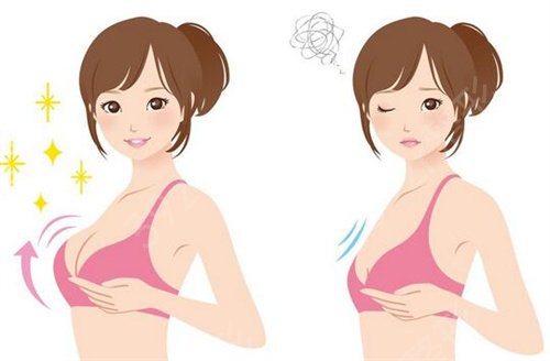 自体脂肪填充丰胸果好吗？