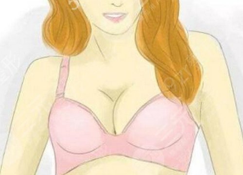 隆胸失败修复手术选择什么材料?后期果如何?